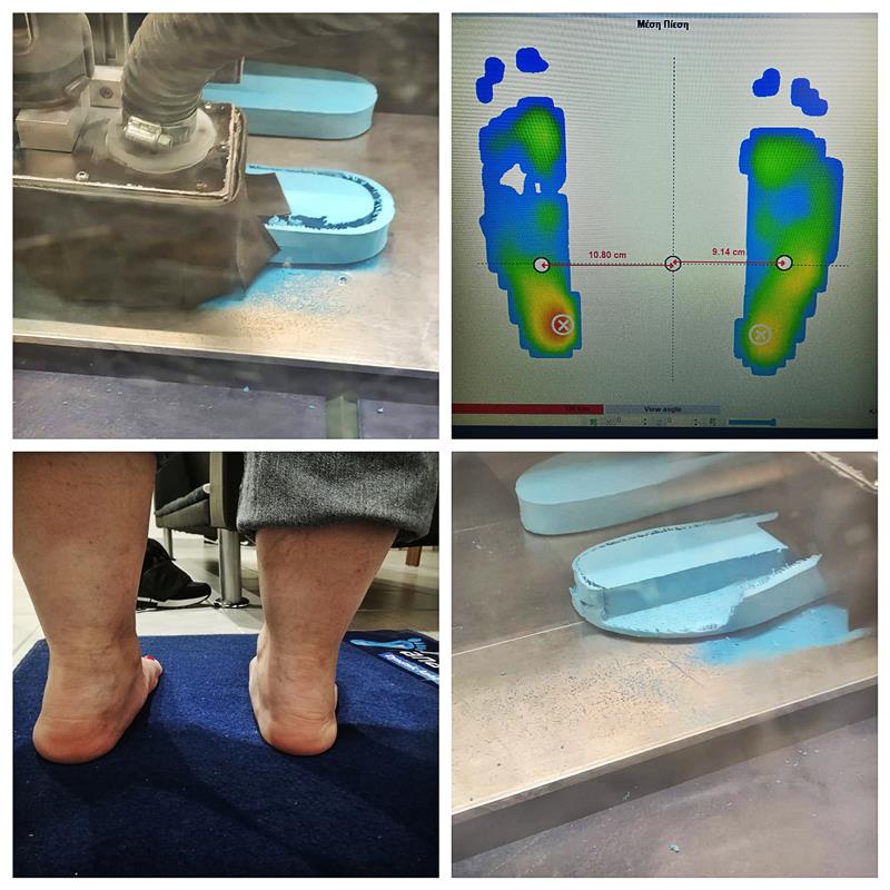 PhysioTerra-Κέντρο Φυσικοθεραπείας: ΨΗΦΙΑΚΗ ΑΝΑΛΥΣΗ ΠΕΛΜΑΤΩΝ-MIRROR SCANNING KAI ΚΑΤΑΣΚΕΥΗ ΕΞΑΤΟΜΙΚΕΥΜΕΝΩΝ ΟΡΘΩΤΙΚΩΝ ΠΕΛΜΑΤΩΝ