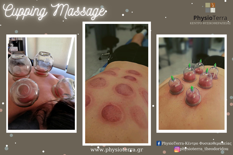 Cupping Massage στο Κέντρο Φυσικοθεραπείας PhysioTerra της Θεοδωρίδου Ειρήνης 